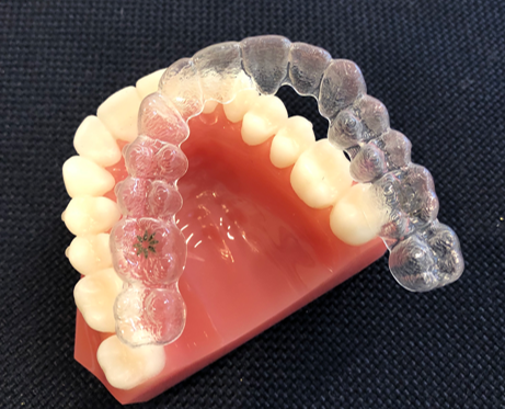 12歳以降の矯正治療のイメージ